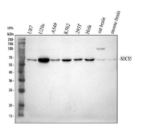 Anti-SOCS5 Antibody Picoband® Boster Bio