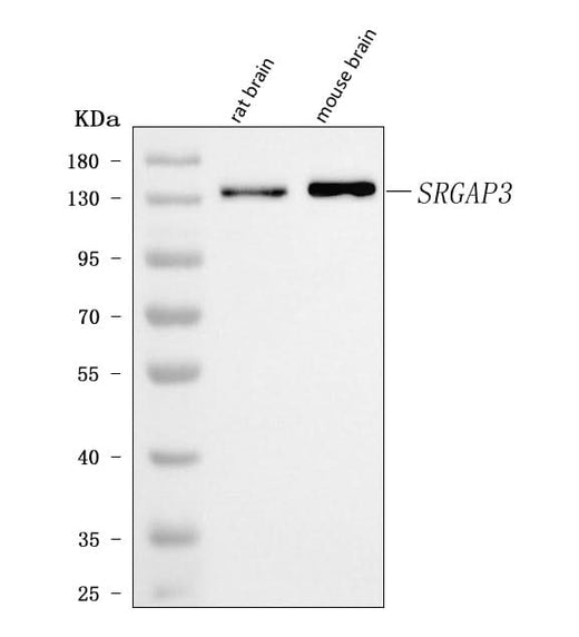 Anti-SRGAP3 Antibody Picoband® Boster Bio
