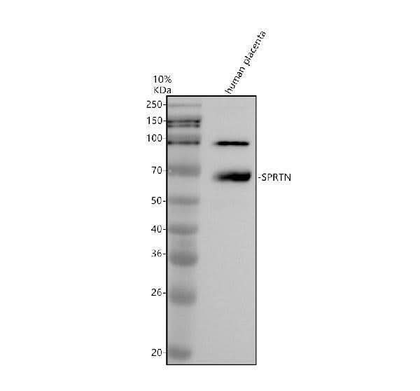 Anti-DTNA Antibody Picoband® Boster Bio