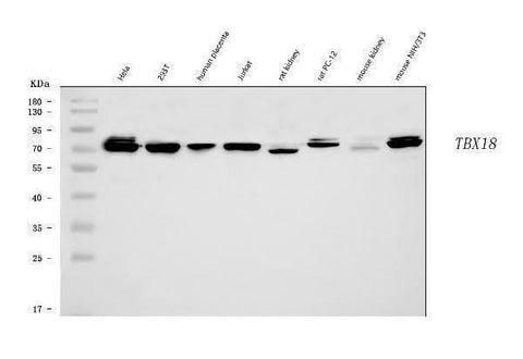 Anti-TBX18 Antibody Picoband® Boster Bio