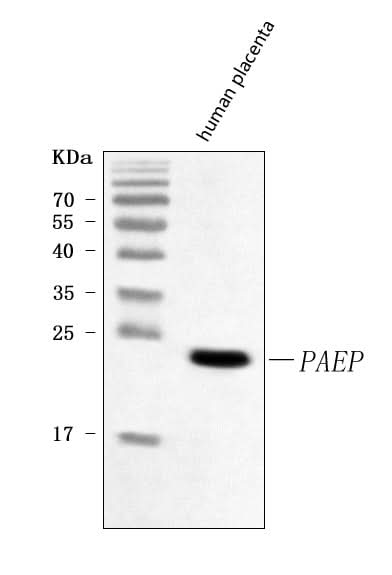 Anti-Glycodelin/PAEP Antibody Picoband® Boster Bio