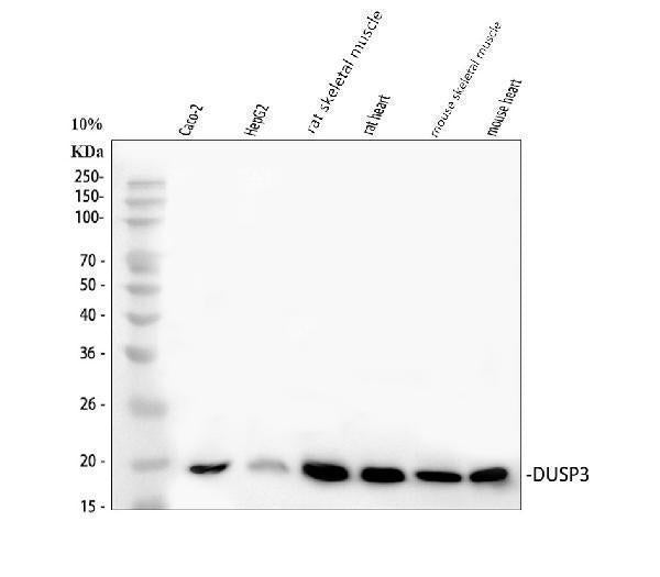 Anti-DUSP3 Picoband® Antibody Boster Bio