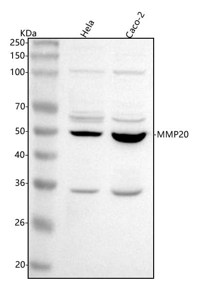 Anti-MMP20 Antibody Picoband® Boster Bio