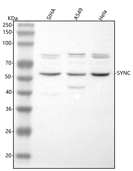 Anti-Syncoilin/SYNC Antibody Picoband® Boster Bio