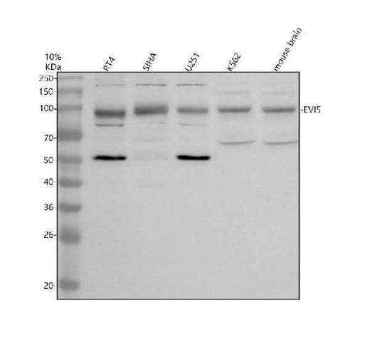 Anti-DTX3L Antibody Picoband® Boster Bio