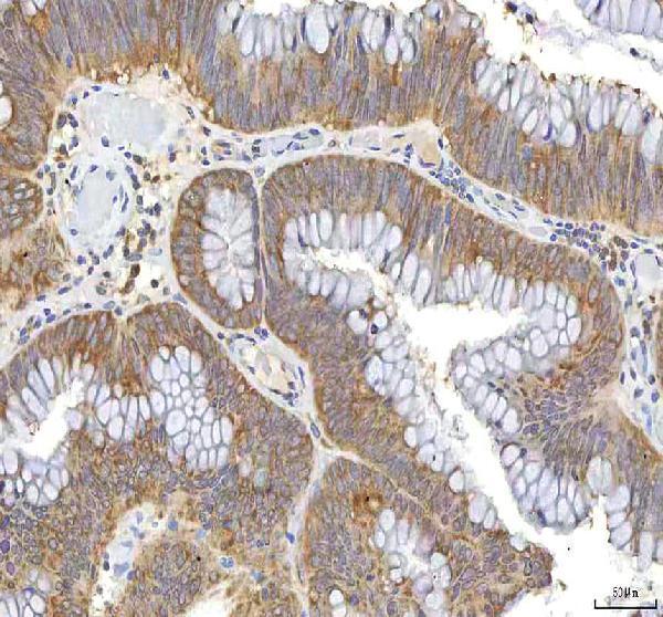 Anti-OCM Antibody Boster Bio