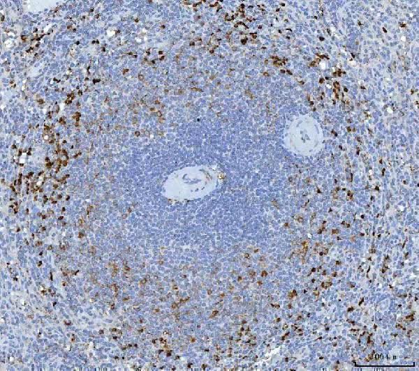 Anti-Granzyme K/GZMK Antibody Boster Bio