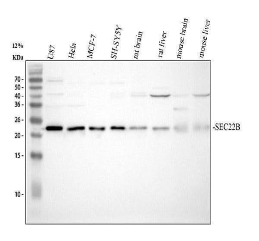 Anti-SEC22B Antibody Picoband® Boster Bio