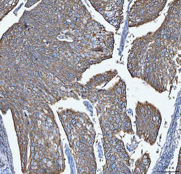 Anti-S100A14 Antibody Boster Bio