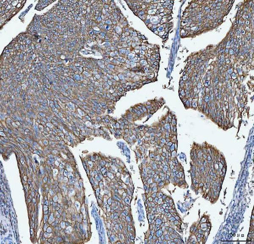 Anti-S100A14 Antibody Boster Bio