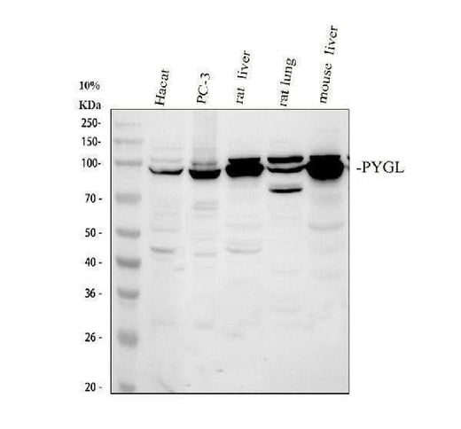 Anti-PYGL Antibody Picoband® Boster Bio