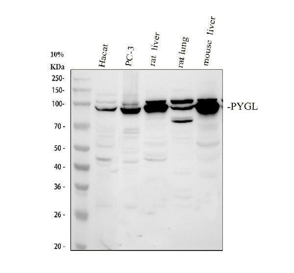 Anti-PYGL Antibody Picoband® Boster Bio
