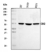 Anti-CBX2 Antibody Picoband® Boster Bio