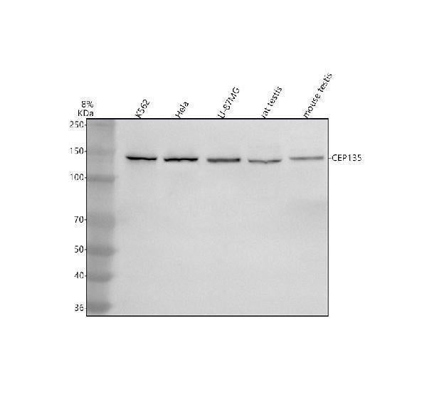 Anti-CEP135 Antibody Picoband® Boster Bio