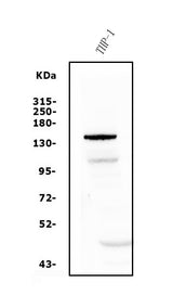 Anti-PTCH2 Antibody Picoband® Boster Bio