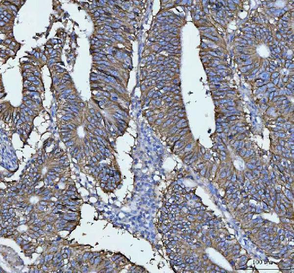 Anti-LI Cadherin/CDH17 Antibody Boster Bio