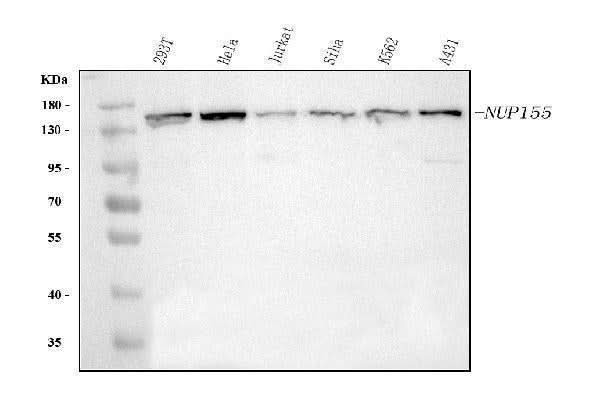 Anti-NUP155 Antibody Picoband® Boster Bio