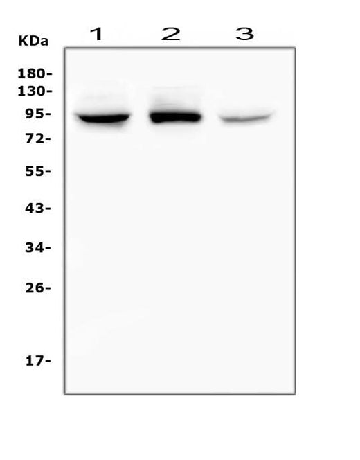 Anti-RASAL1/RASAL1 Antibody Picoband® Boster Bio