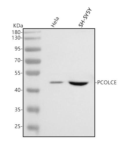 Anti-PCOLCE Antibody Picoband® Boster Bio