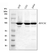 Anti-RECK Antibody Picoband® Boster Bio