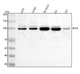 Anti-RECK Antibody Picoband® Boster Bio
