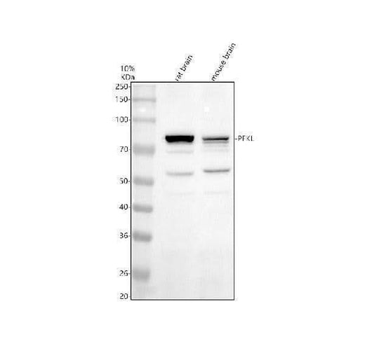 Anti-PFKL Antibody Picoband® Boster Bio