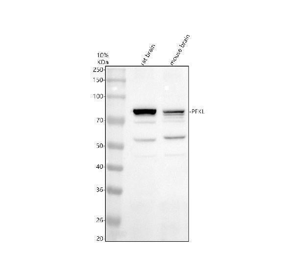 Anti-PFKL Antibody Picoband® Boster Bio