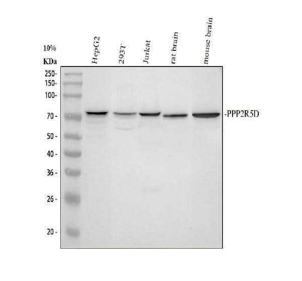 Anti-PPP2R5D Antibody Picoband® Boster Bio
