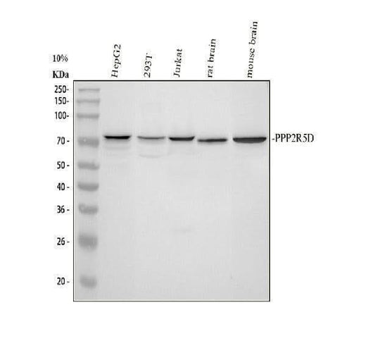 Anti-PPP2R5D Antibody Picoband® Boster Bio