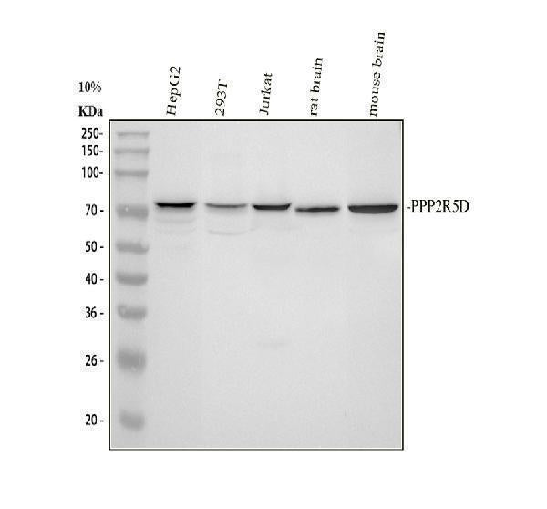 Anti-PPP2R5D Antibody Picoband® Boster Bio