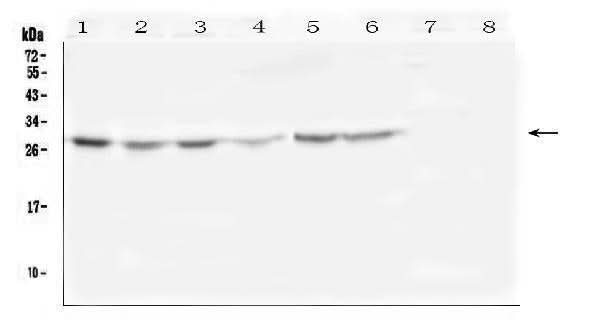 Anti-SCN4B Antibody Picoband® Boster Bio