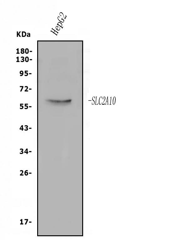 Anti-GLUT10/SLC2A10 Antibody Picoband® Boster Bio