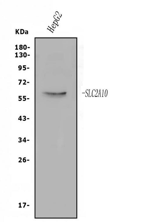 Anti-GLUT10/SLC2A10 Antibody Picoband® Boster Bio