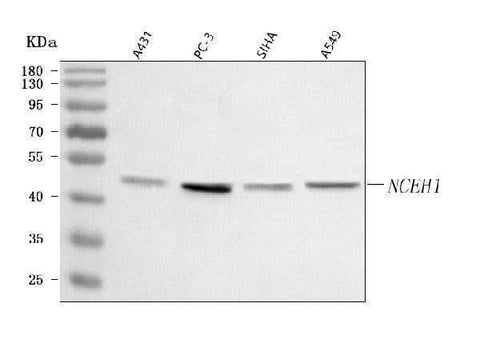Anti-AADACL1/NCEH1 Antibody Picoband® Boster Bio
