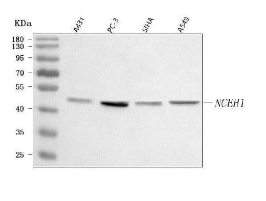 Anti-AADACL1/NCEH1 Antibody Picoband® Boster Bio