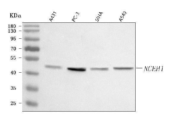 Anti-AADACL1/NCEH1 Antibody Picoband® Boster Bio