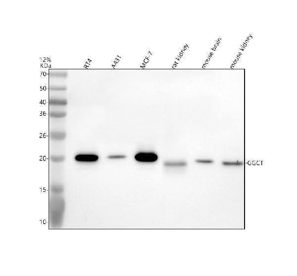 Anti-GGCT Antibody Picoband® Boster Bio
