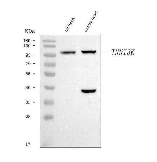 Anti-TNNI3K Antibody Picoband® Boster Bio