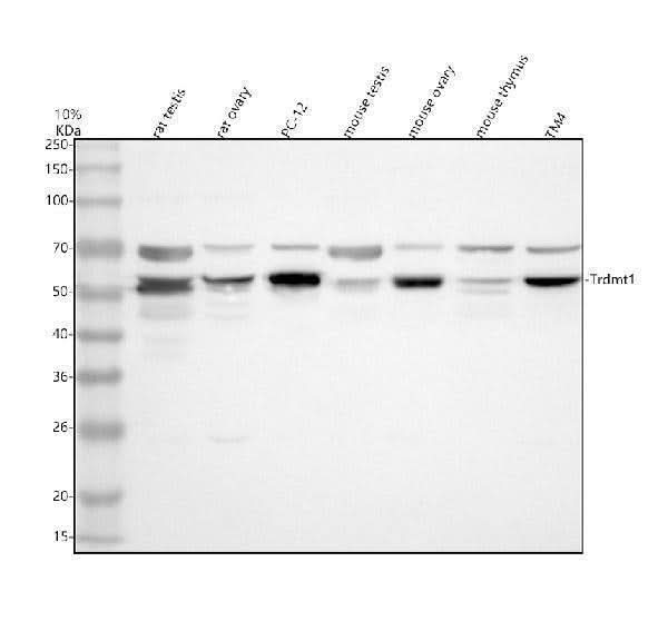 Anti-DNMT2/TRDMT1 Antibody Picoband® Boster Bio