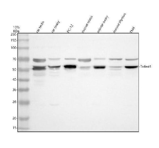 Anti-DNMT2/TRDMT1 Antibody Picoband® Boster Bio