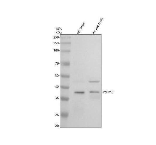 Anti-PDLIM2 Antibody Picoband® Boster Bio