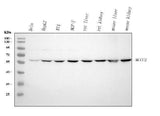 Anti-MCCC2 Antibody Picoband® Boster Bio