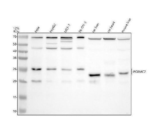 Anti-PGRMC2 Antibody Picoband® Boster Bio