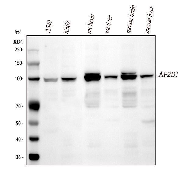 Anti-AP2B1 Antibody Picoband® Boster Bio