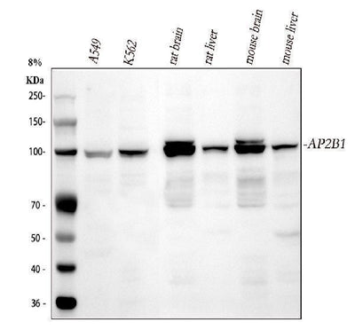 Anti-AP2B1 Antibody Picoband® Boster Bio