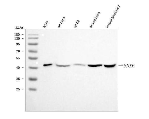 Anti-SNX6 Antibody Picoband® Boster Bio