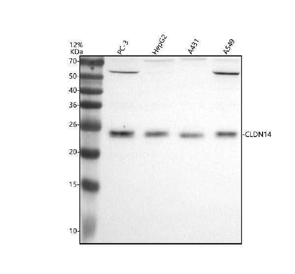 Anti-CLDN14 Antibody Picoband® Boster Bio