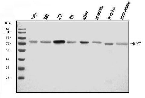Anti-ACP2 Antibody Picoband® Boster Bio