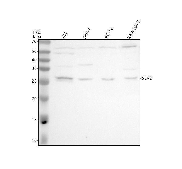 Anti-SLA2 Antibody Picoband® Boster Bio