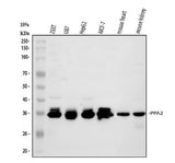 Anti-PPA2 Antibody Picoband® Boster Bio